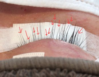 寒さでケア怠慢⁉️私が代わりにやる気スイッチ押しますょ😍👍