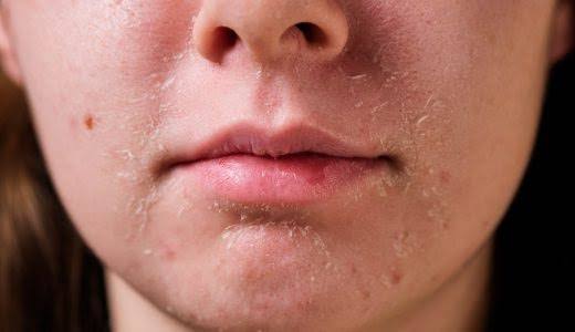 トラブルの改善🤔まずは何から❓