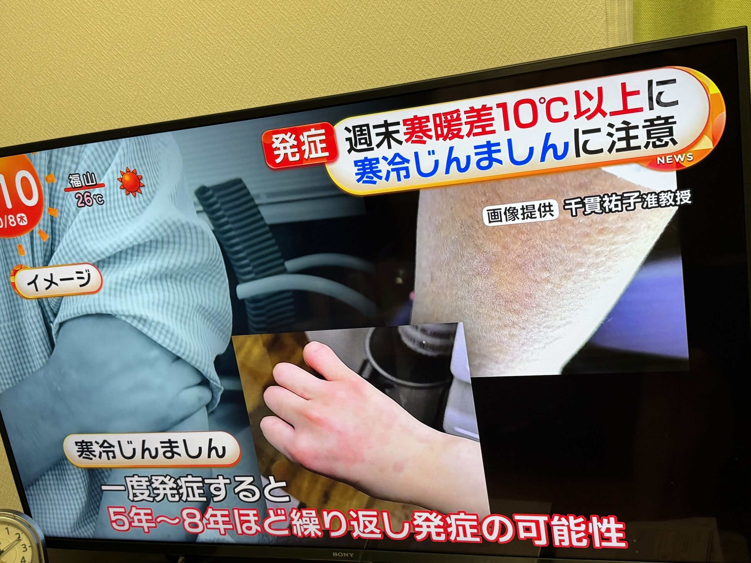 もしかして🫣発症してませんか⁉️🫣💦