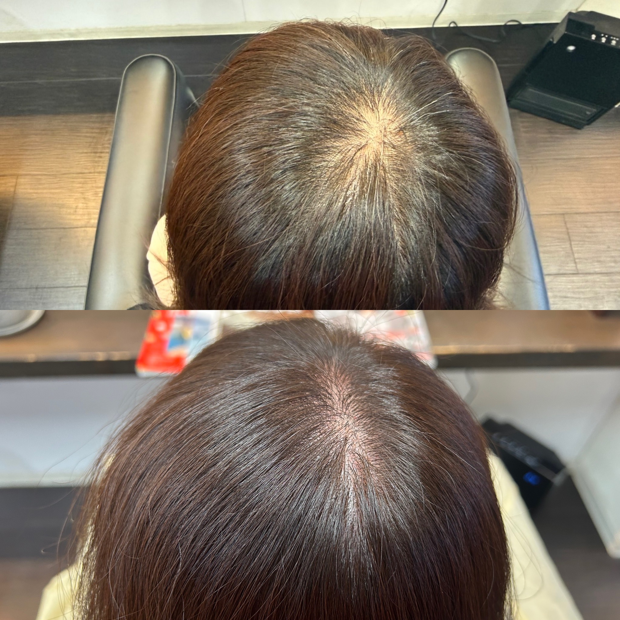 「育毛」　千里の道も一歩から🚶‍♀️